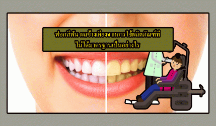 ฟอกสีฟัน ผลข้างเคียงจากการใช้ผลิตภัณฑ์ที่ไม่ได้มาตรฐานเป็นอย่างไร